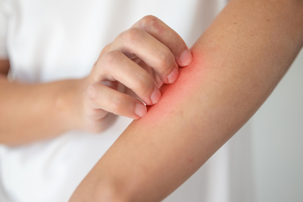 Jute Rug Allergies and Health Considerations - Skin Irritations